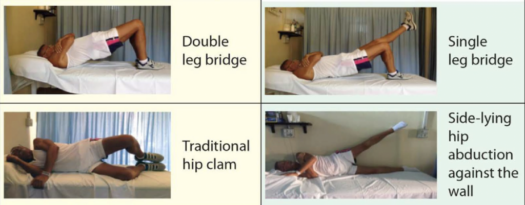 Das Bild zeigt vier verschiedene Übungen zur Stärkung der Hüftmuskulatur, insbesondere nach einer Hüft-Totalendoprothese (Hüft-TEP):
Oben links: "Double leg bridge" – Die Person liegt auf dem Rücken mit angewinkelten Knien und hebt das Becken an, um eine Brücke mit beiden Beinen auszuführen. Diese Übung stärkt die Gesäß- und Rumpfmuskulatur.
Oben rechts: "Single leg bridge" – Eine Variation der Brücke, bei der ein Bein gestreckt in die Luft gehoben wird, während das Becken nach oben gedrückt wird. Diese Übung fordert zusätzlich die Stabilität und Kraft der Hüftmuskulatur.
Unten links: "Traditional hip clam" – In Seitenlage werden die Knie angewinkelt, während die Füße zusammenbleiben. Das obere Knie wird kontrolliert angehoben, um die äußere Hüftmuskulatur (Abduktoren) zu aktivieren.
Unten rechts: "Side-lying hip abduction against the wall" – Die Person liegt seitlich an einer Wand und hebt das obere Bein gestreckt an. Diese Übung trainiert gezielt die Abduktoren der Hüfte, unterstützt die Stabilität und verbessert die seitliche Beweglichkeit.
Diese Übungen sind besonders für die Rehabilitation nach einer Hüft-TEP geeignet, da sie die Hüftstabilität, Kraft und Kontrolle fördern.